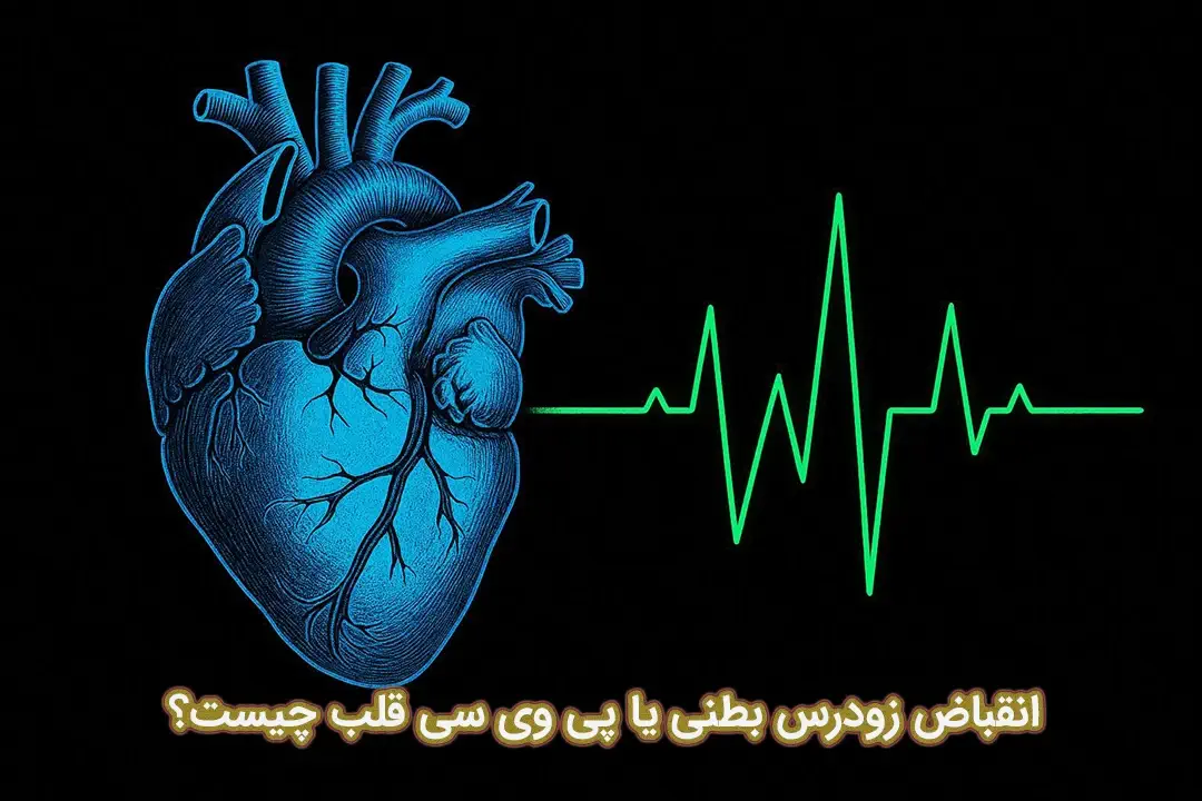 انقباض زودرس بطنی انقباض زودرس بطنی
