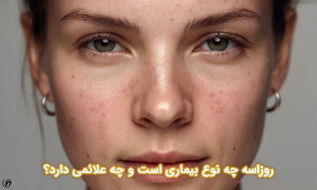 روزاسه روزاسه