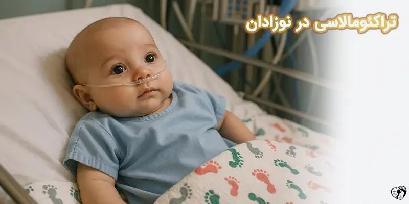 Tracheomalacia تراکئومالاسی در نوزادان