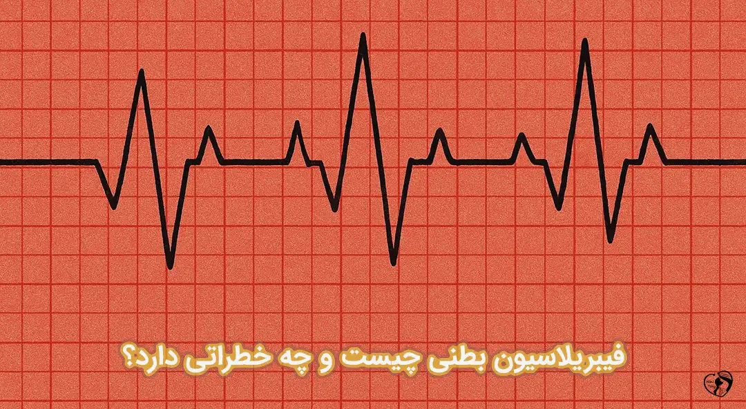 فیبریلاسیون بطنی فیبریلاسیون بطنی