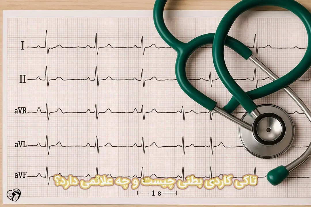 تاکی کاردی بطنی تاکی کاردی بطنی