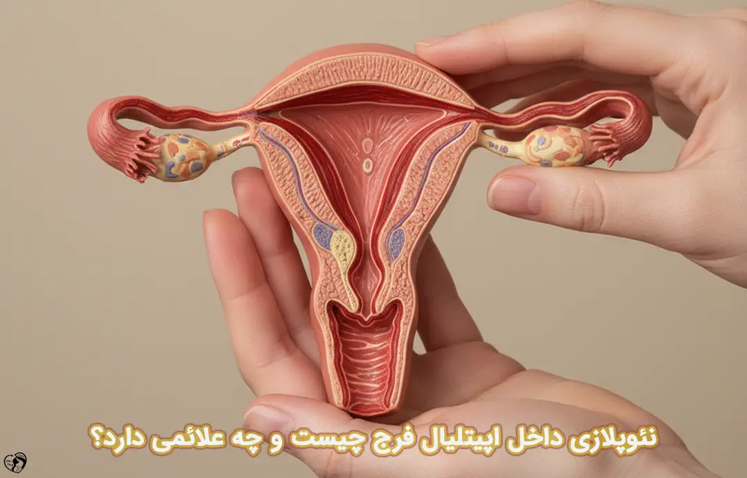 نئوپلازی داخل اپیتلیال فرج نئوپلازی داخل اپیتلیال فرج
