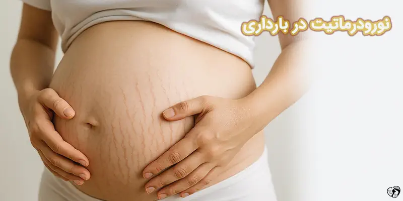 What to do if you have neurodermatitis during pregnancy نورودرماتیت در بارداری