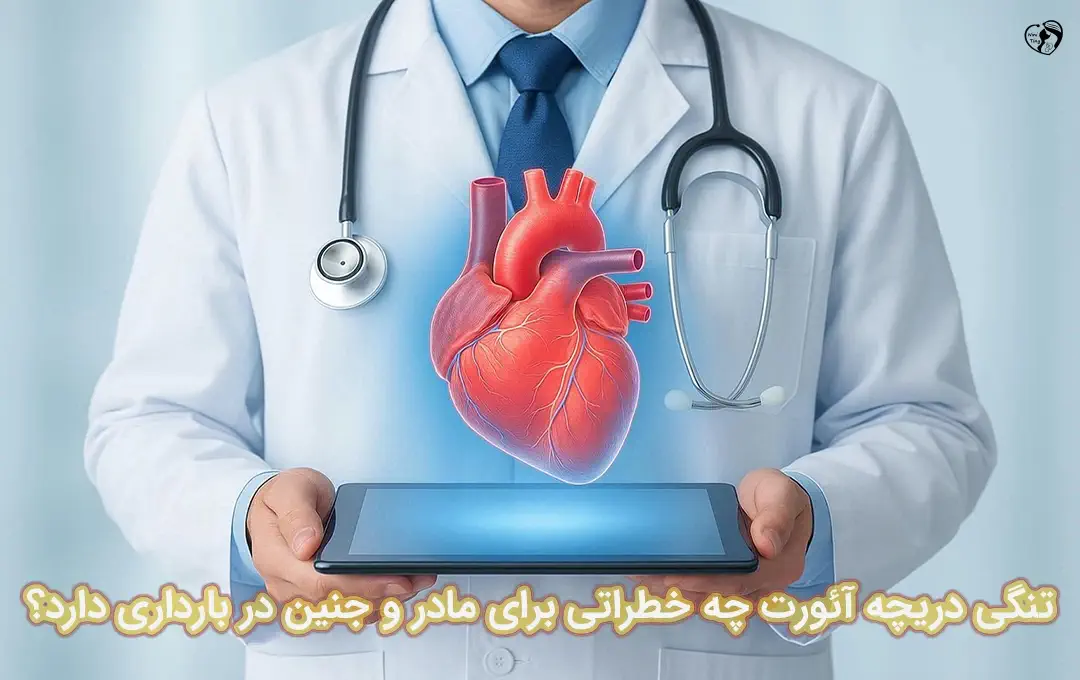 تنگی دریچه آئورت در بارداری تنگی دریچه آئورت در بارداری