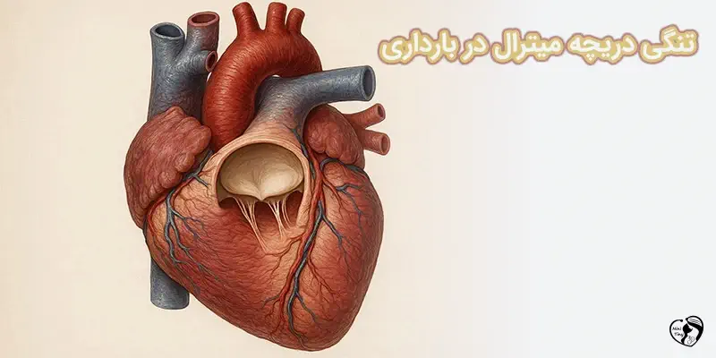 tangi mitral تنگی دریچه میترال در بارداری