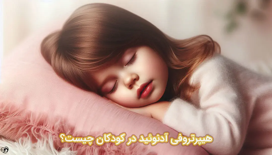 هیپرتروفی آدنوئید در کودکان هیپرتروفی آدنوئید در کودکان