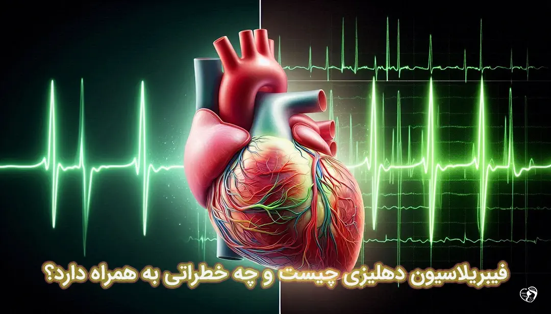فیبریلاسیون دهلیزی فیبریلاسیون دهلیزی