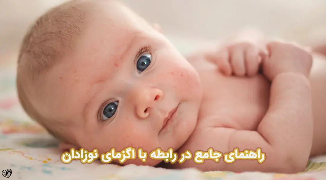 اگزما در نوزادان