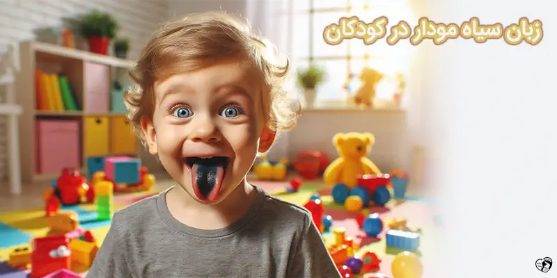Black Hairy Tongue زبان سیاه مودار در کودکان