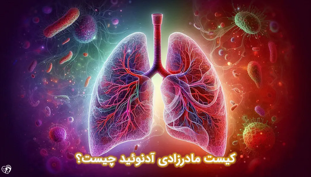 کیست مادرزادی آدنوئید