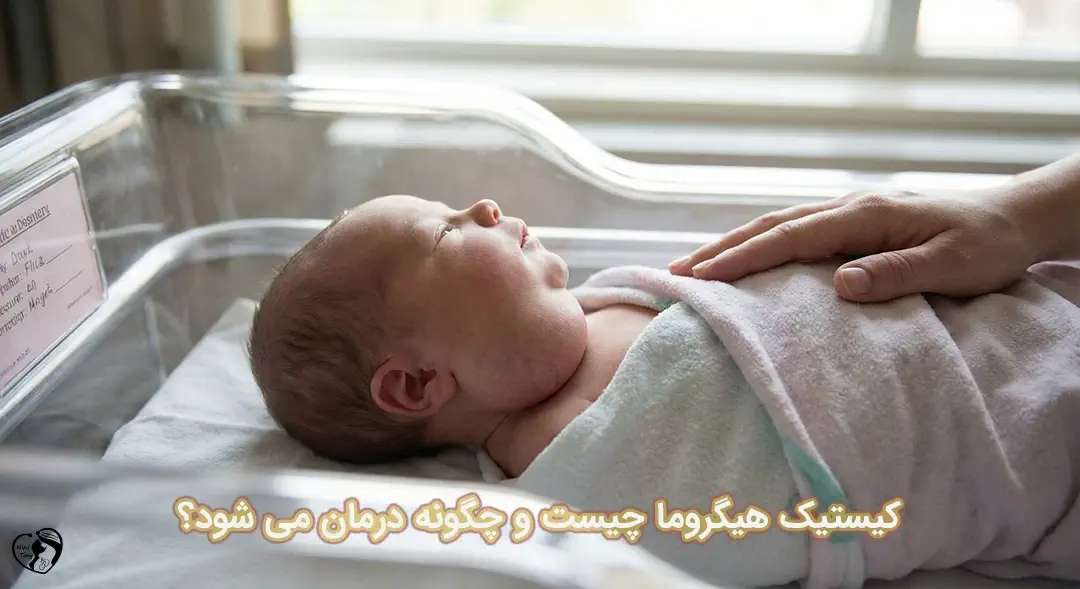 کیستیک هیگروما