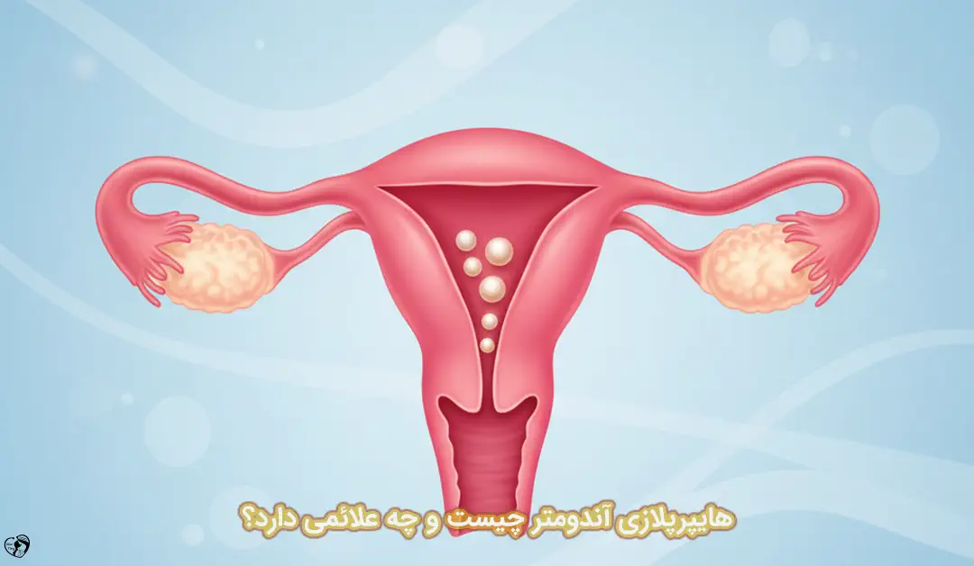 هایپرپلازی آندومتر