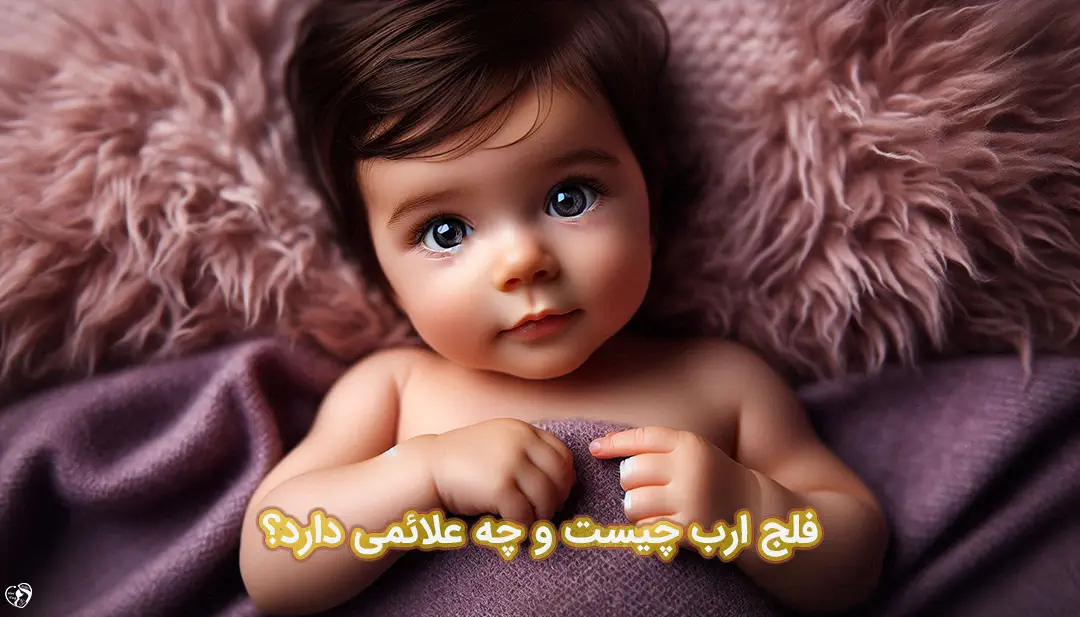 فلج ارب در نوزادان