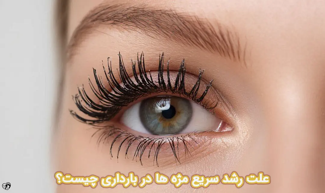 رشد مژه در بارداری