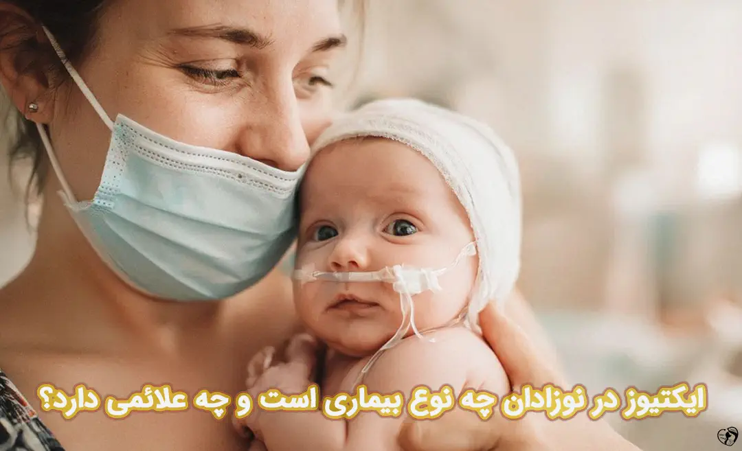 ایکتیوز در نوزادان ایکتیوز در نوزادان