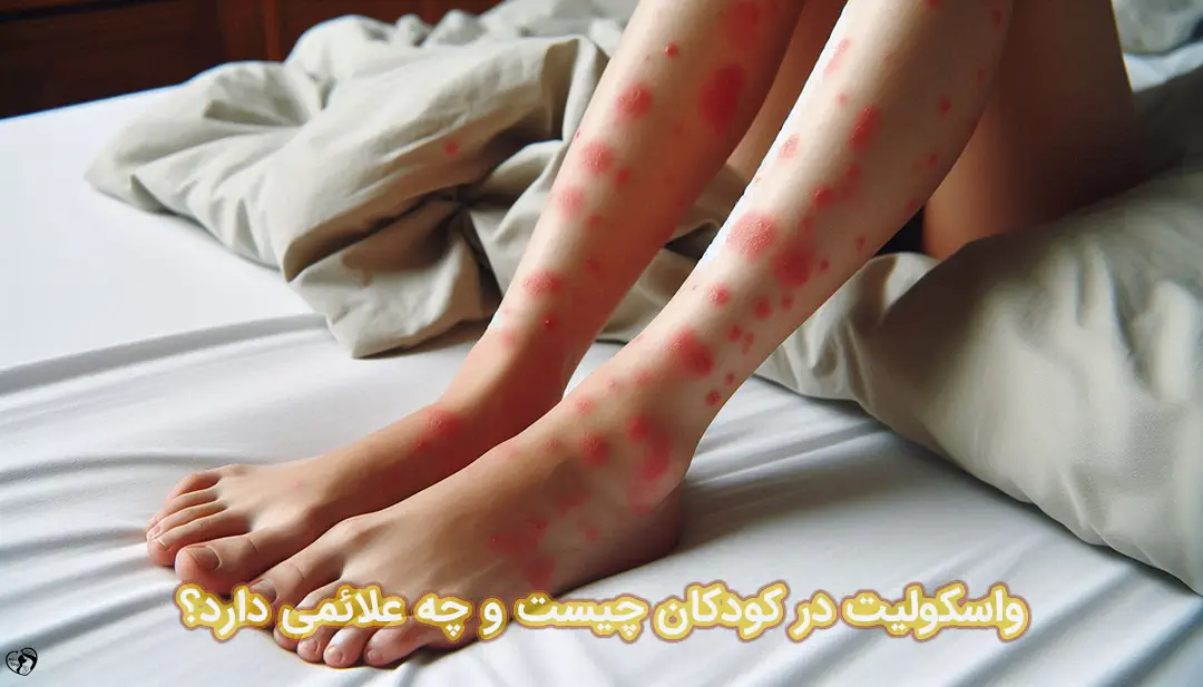 پورپورای هنوخ شوئن لاین