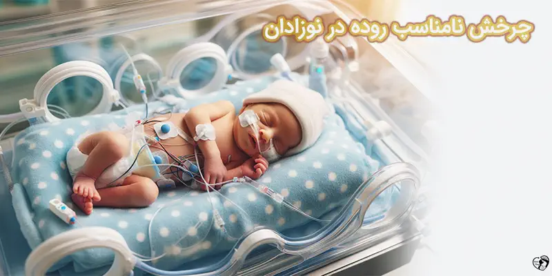 Malrotation in Children چرخش نامناسب روده در نوزادان