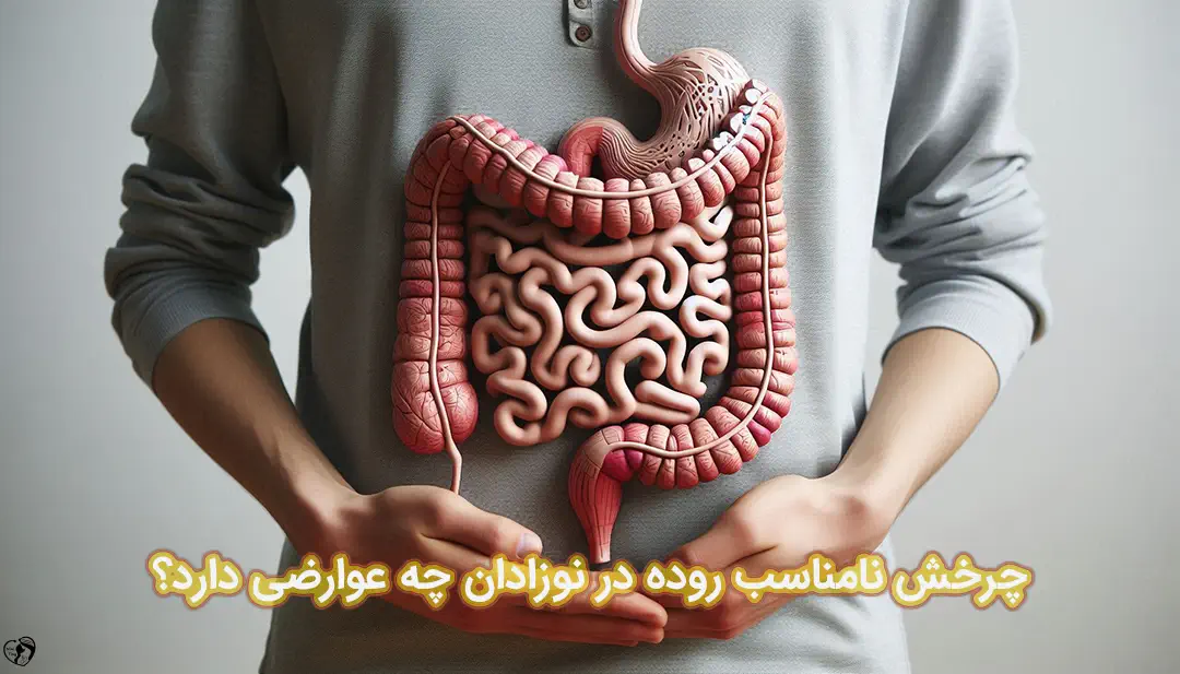 چرخش نامناسب روده در نوزادان