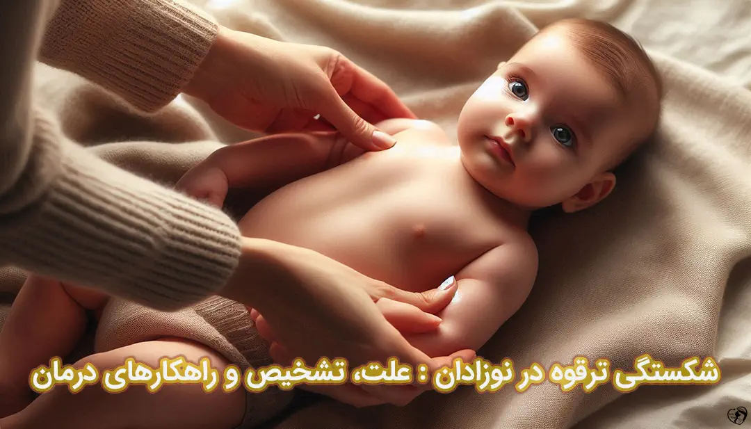 شکستگی ترقوه در نوزادان شکستگی ترقوه در نوزادان