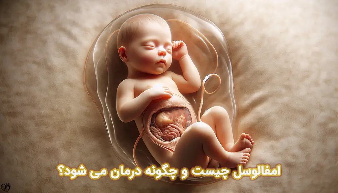 امفالوسل امفالوسل