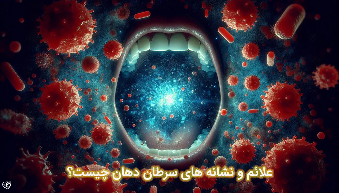 سزطان دهان سزطان دهان