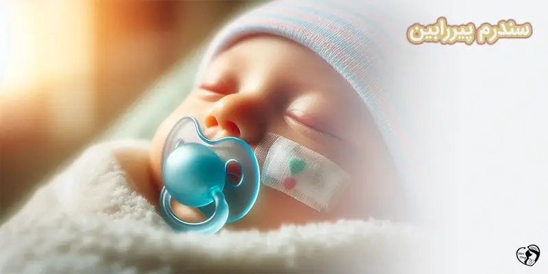 Pierre Robin Syndrome سندرم پیررابین