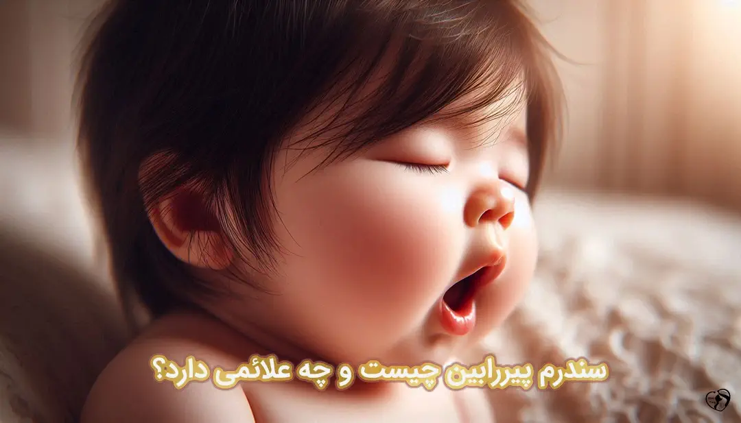 سندرم پیررابین