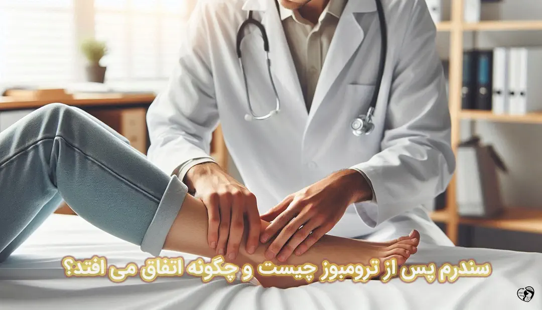 سندرم پس از ترومبوز سندرم پس از ترومبوز