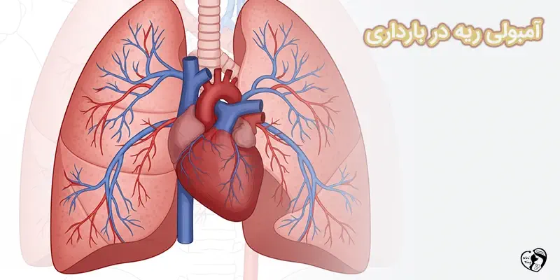 Pulmonary Embolism During Pregnancy آمبولی ریه در بارداری
