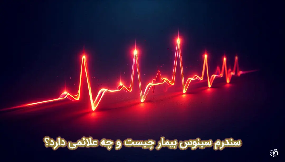 سندرم سینوس بیمار