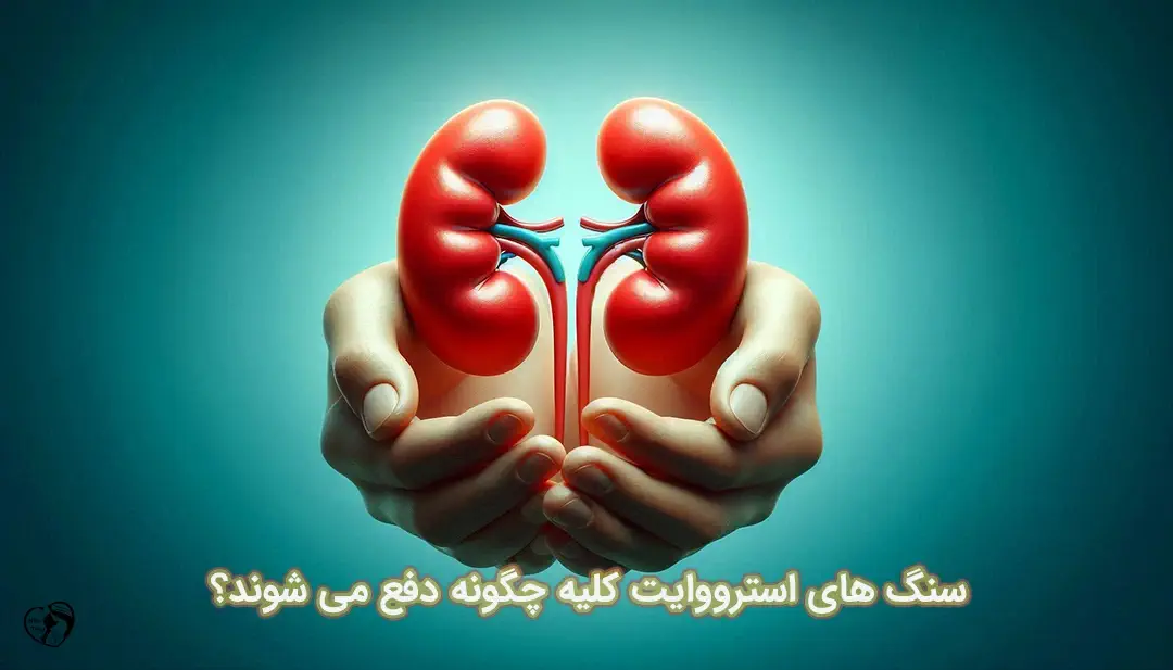 سنگ های استرووایت کلیه سنگ های استرووایت کلیه