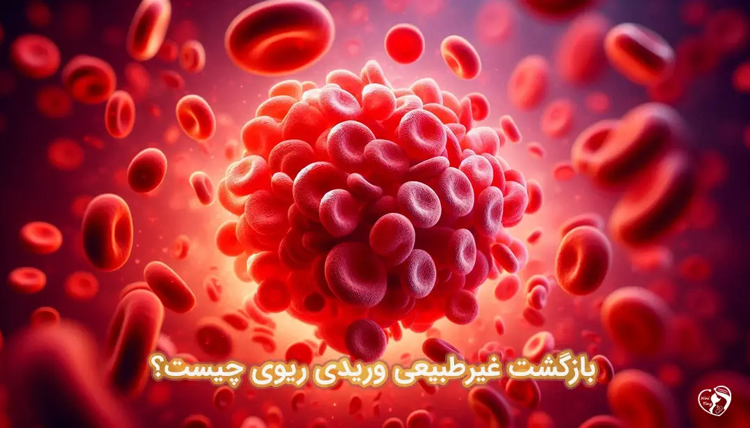 بازگشت غیرطبیعی وریدی ریوی