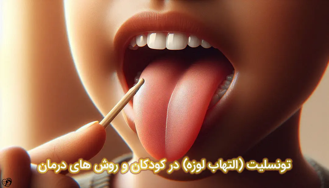 تونسلیت در کودکان تونسلیت در کودکان