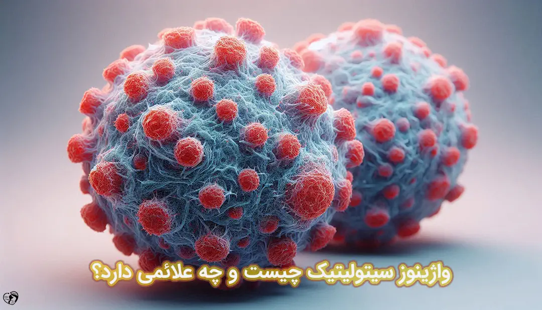 واژینوز سیتولیتیک واژینوز سیتولیتیک