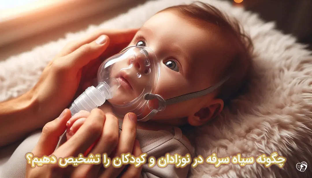 سیاه سرفه در نوزادان سیاه سرفه در نوزادان