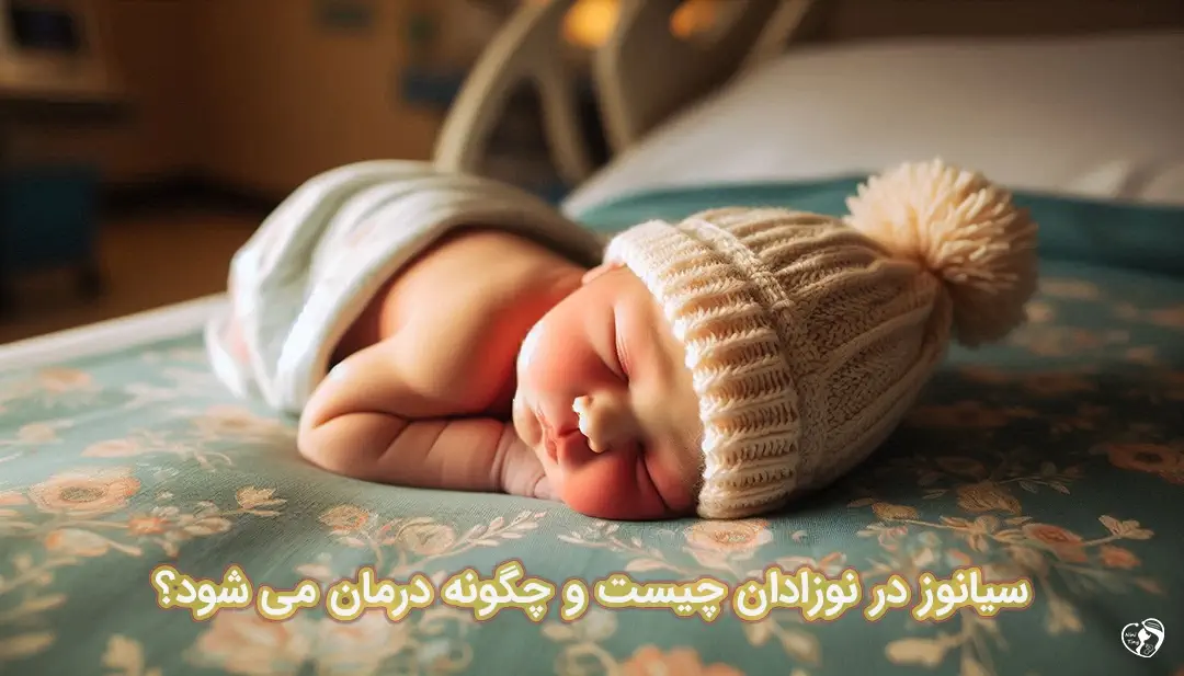 سیانوز در نوزادان سیانوز در نوزادان