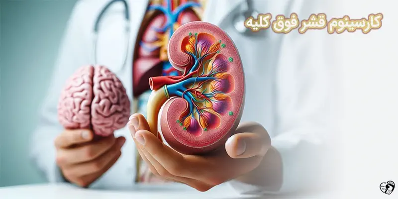 Adrenocortical Carcinoma کارسینوم قشر فوق کلیه