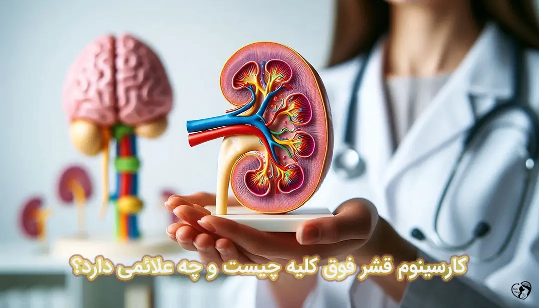 کارسینوم قشر فوق کلیه کارسینوم قشر فوق کلیه