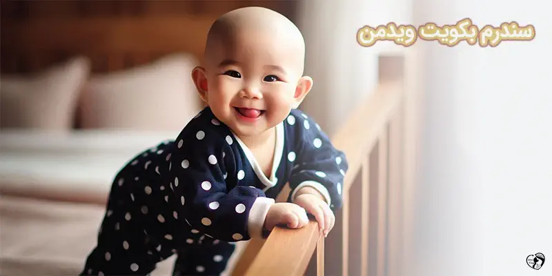 سندرم بکویت ویدمن