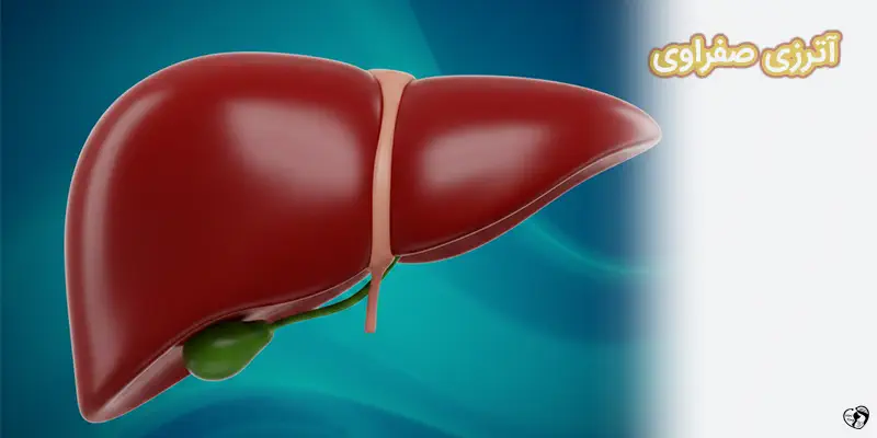 Biliary Atresia آترزی صفراوی