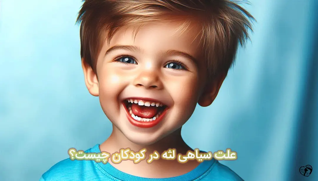 سیاهی لثه در کودکان سیاهی لثه در کودکان
