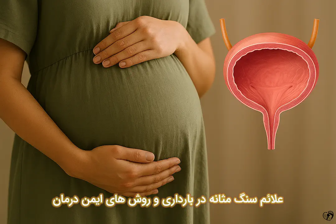 سنگ مثانه در بارداری سنگ مثانه در بارداری