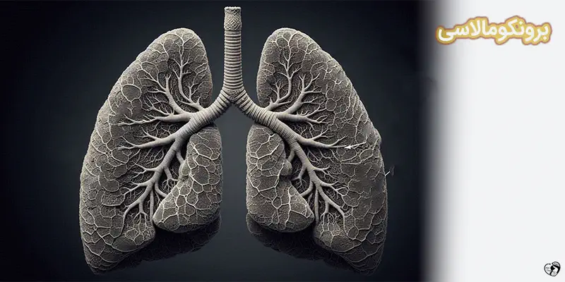 برونکومالاسی