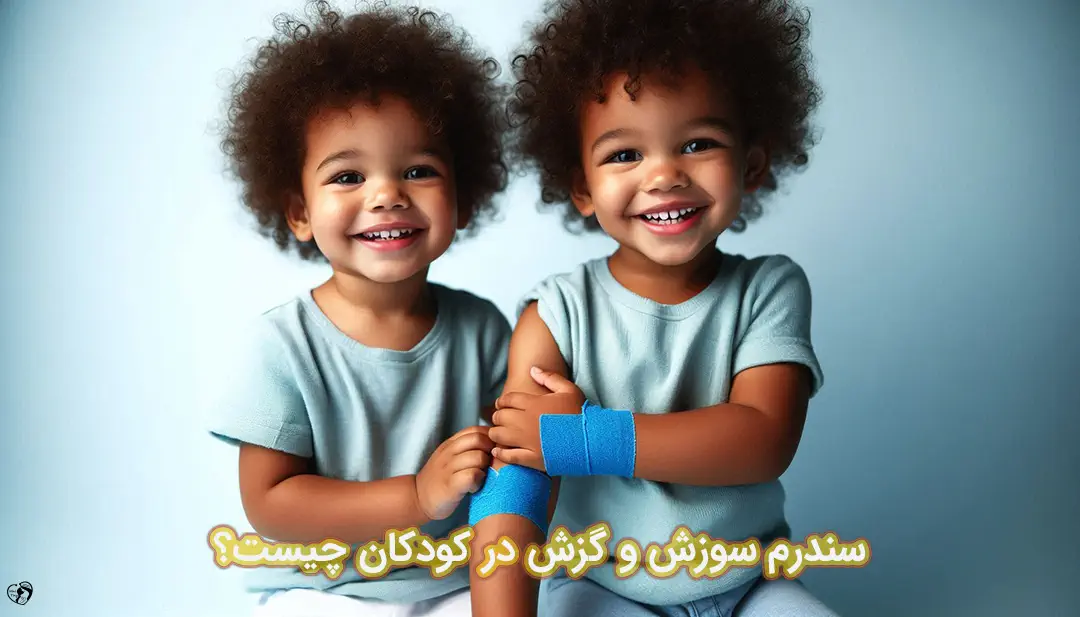سندرم سوزش و گزش در کودکان