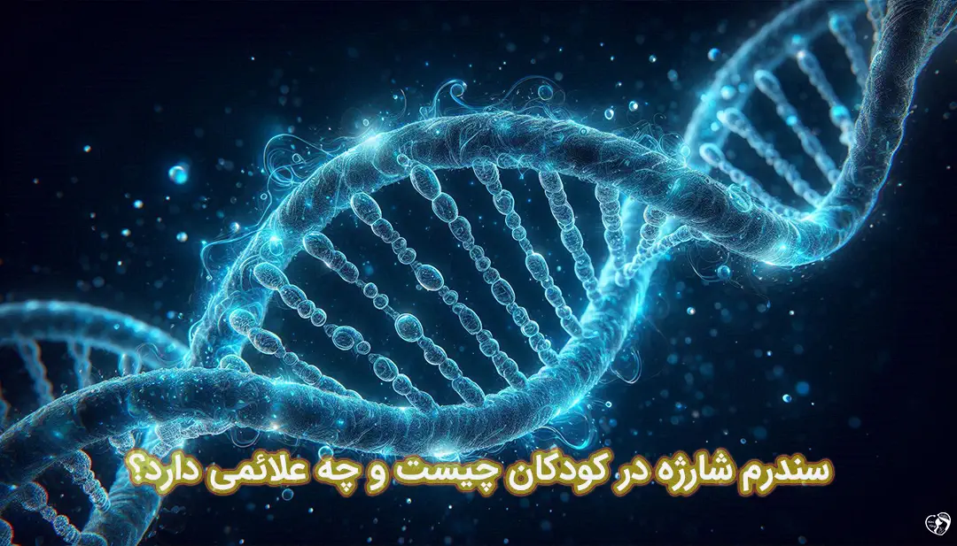 سندرم شارژه در کودکان