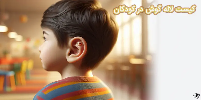 Earlobe Cysts کیست لاله گوش در کودکان