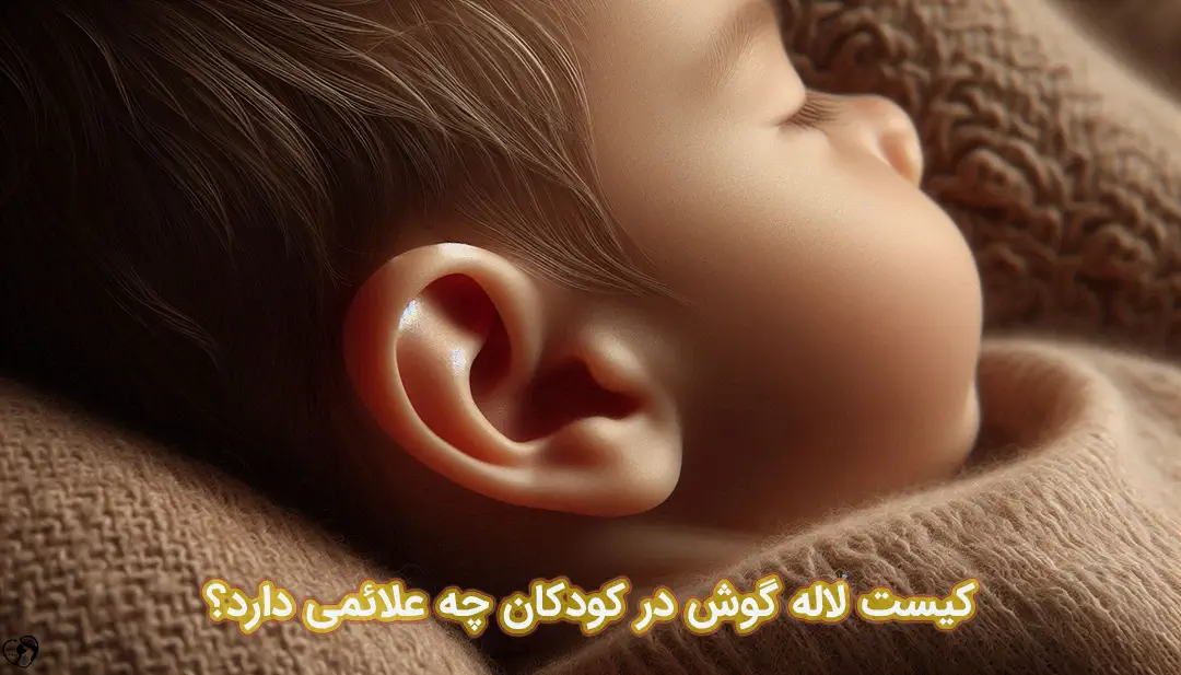 کیست لاله گوش در کودکان کیست لاله گوش در کودکان