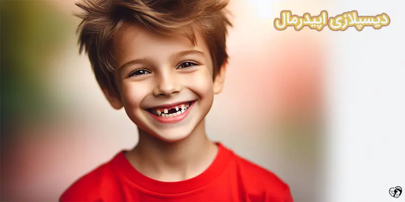 Ectodermal Dysplasia دیسپلازی اپیدرمال