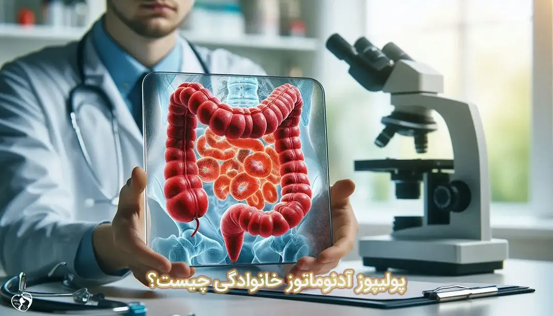 پولیپوز آدنوماتوز خانوادگی