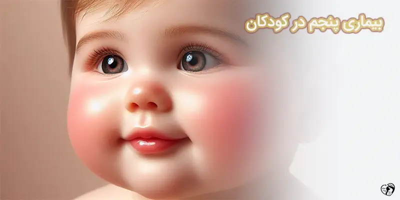 بیماری پنجم در کودکان